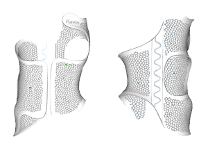 宋立志工作室3D打印支具